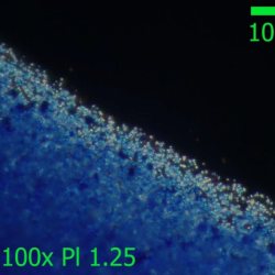 Microscope condenser, Darkfield ...